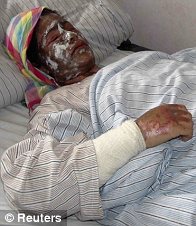 Muçulmana queimada3