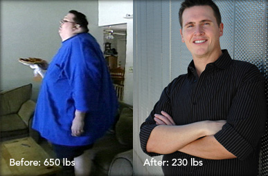 perca de peso antes e depois1