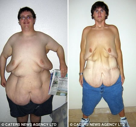 perca de peso antes e depois3