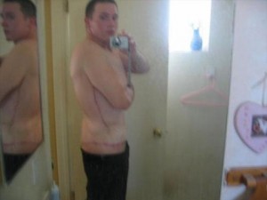 perca de peso antes e depois5